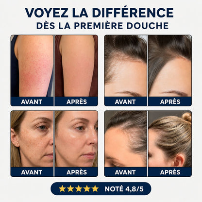 Hydralys™ – Pommeau Filtrant Haute Pression